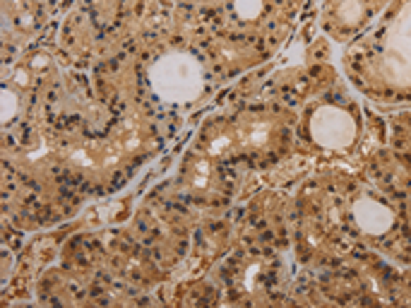 Rabbit Polyclonal Antibody to KCNN4