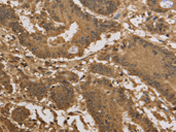 Rabbit Polyclonal Antibody to KDM5B