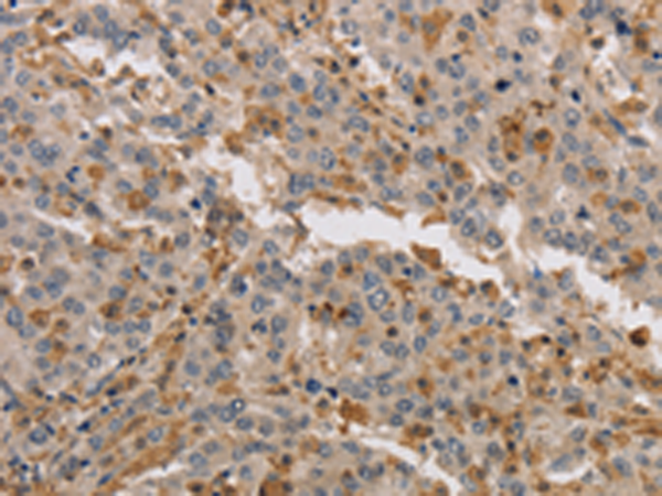 Rabbit Polyclonal Antibody to KIF17