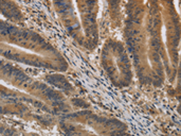 Rabbit Polyclonal Antibody to KIF22
