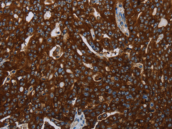 Rabbit Polyclonal Antibody to KISS1R