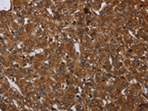 Rabbit Polyclonal Antibody to ARHGEF12