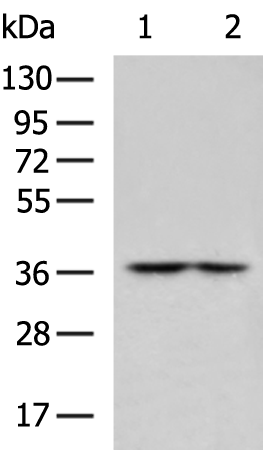 Rabbit Polyclonal Antibody to CERS1