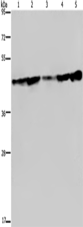 Rabbit Polyclonal Antibody to CERS4