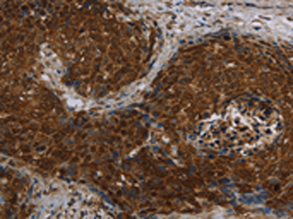 Rabbit Polyclonal Antibody to CERS5