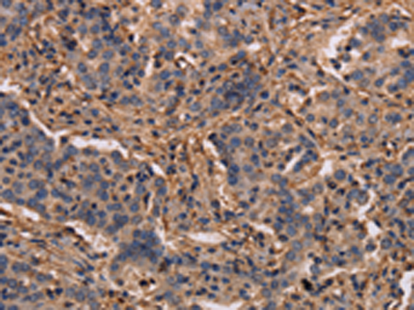 Rabbit Polyclonal Antibody to MAP1LC3C