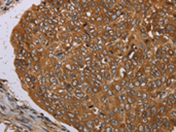 Rabbit Polyclonal Antibody to PIM3