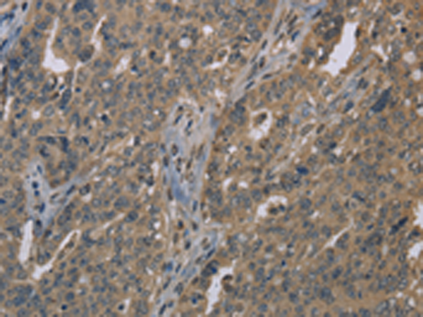 Rabbit Polyclonal Antibody to LGR4