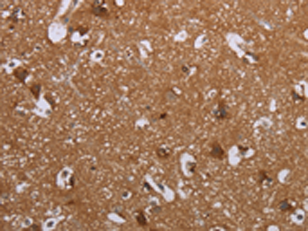 Rabbit Polyclonal Antibody to LIMK1