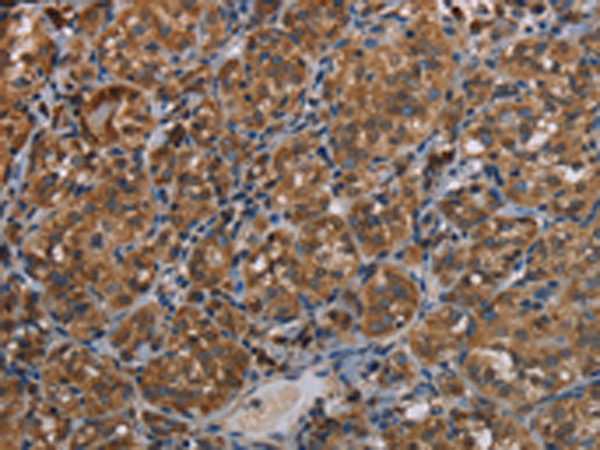 Rabbit Polyclonal Antibody to LLGL1