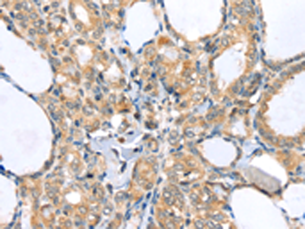 Rabbit Polyclonal Antibody to LLGL2