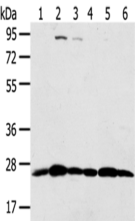 Rabbit Polyclonal Antibody to PSMB8