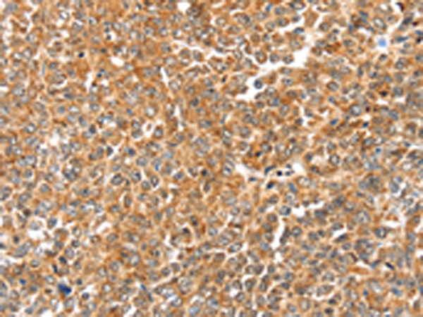 Rabbit Polyclonal Antibody to LOXL2