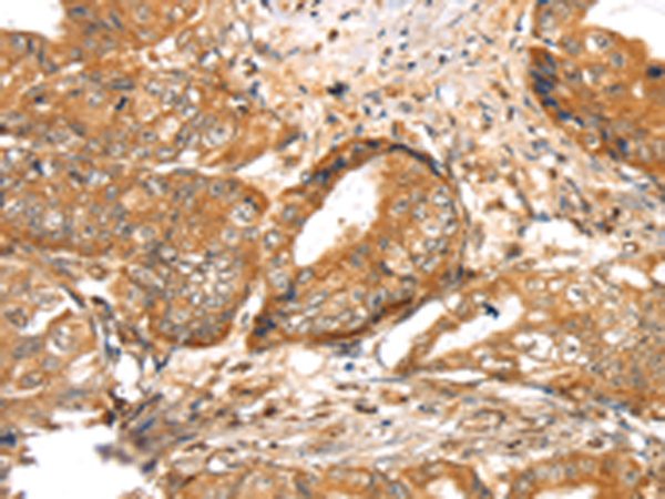 Rabbit Polyclonal Antibody to LOXL4