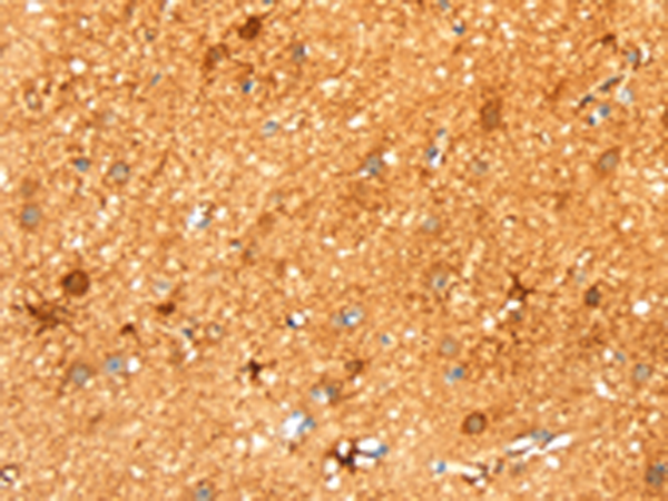 Rabbit Polyclonal Antibody to LPP