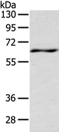 Rabbit Polyclonal Antibody to LZTS1