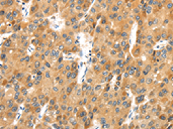 Rabbit Polyclonal Antibody to MACC1