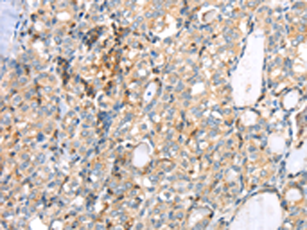 Rabbit Polyclonal Antibody to MAGEB2