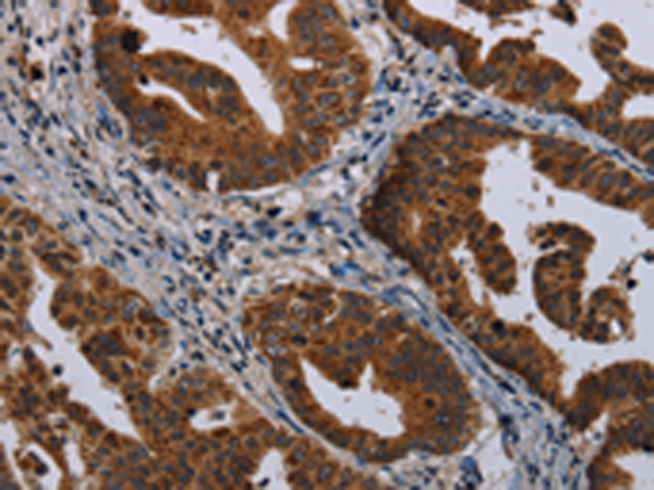 Rabbit Polyclonal Antibody to MAGEB3