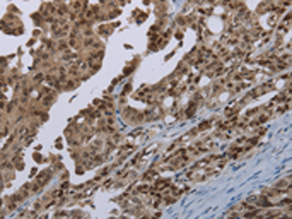Rabbit Polyclonal Antibody to MAGEB18