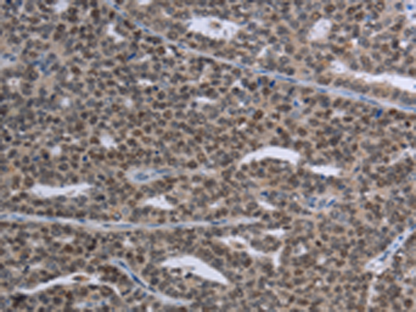 Rabbit Polyclonal Antibody to MAGEC1