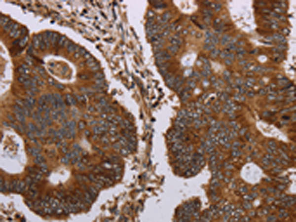Rabbit Polyclonal Antibody to MAGEC2