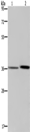 Rabbit Polyclonal Antibody to MAGEF1