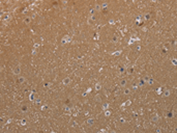 Rabbit Polyclonal Antibody to MAGEL2
