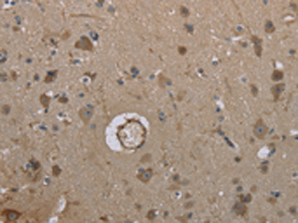 Rabbit Polyclonal Antibody to MARK4