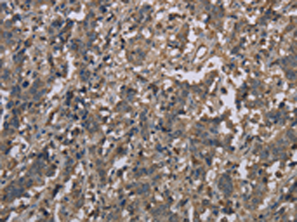 Rabbit Polyclonal Antibody to MCC