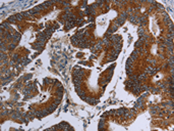 Rabbit Polyclonal Antibody to MDFIC