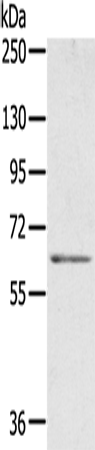 Rabbit Polyclonal Antibody to ME1