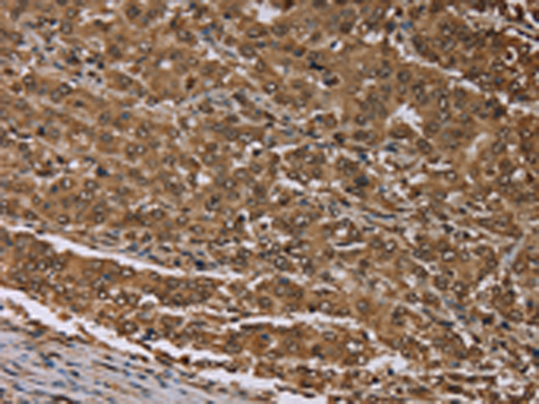 Rabbit Polyclonal Antibody to MEIS1