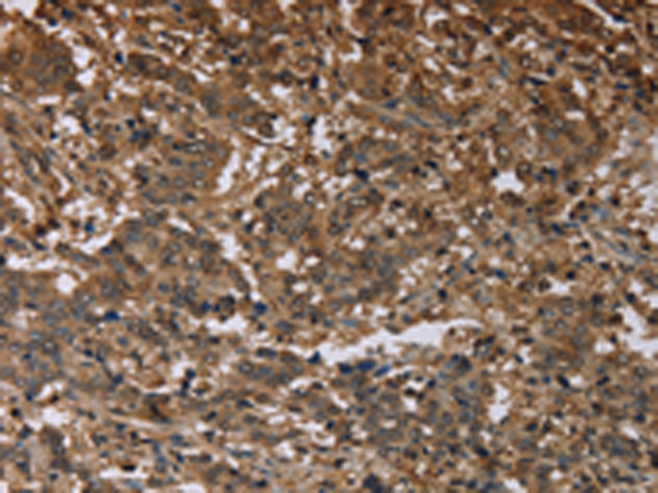 Rabbit Polyclonal Antibody to MFF