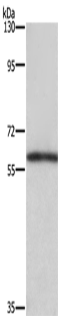 Rabbit Polyclonal Antibody to TBX5