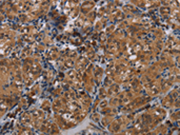 Rabbit Polyclonal Antibody to TRPV1