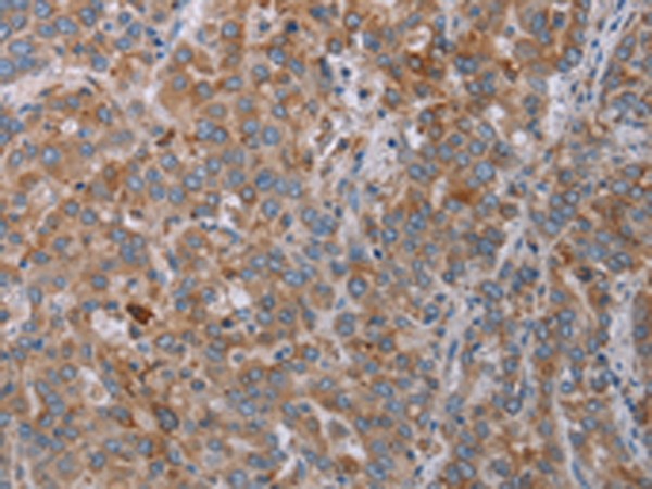 Rabbit Polyclonal Antibody to REG3A