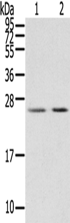 Rabbit Polyclonal Antibody to MIG7