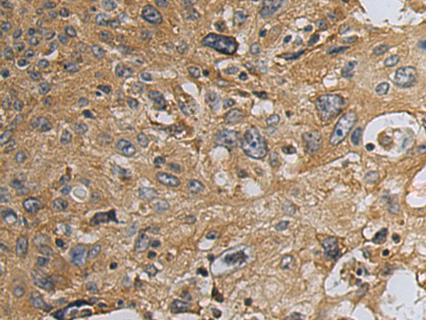 Rabbit Polyclonal Antibody to ERRFI1