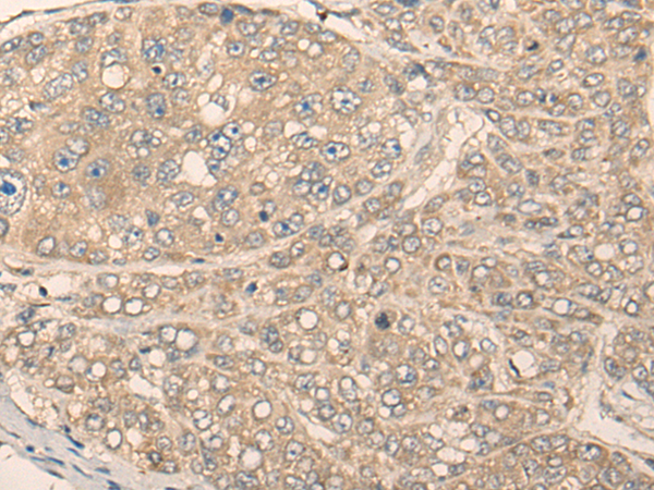 Rabbit Polyclonal Antibody to MIIP