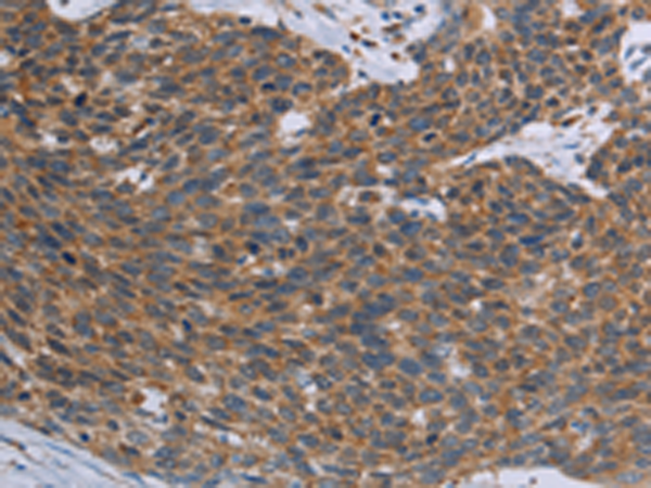 Rabbit Polyclonal Antibody to TNPO1