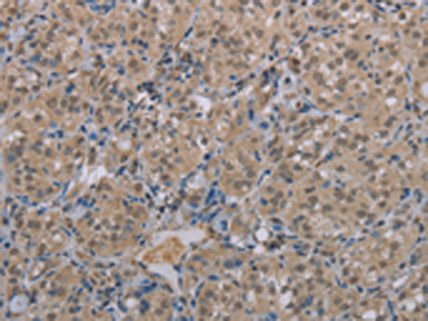 Rabbit Polyclonal Antibody to MGLL