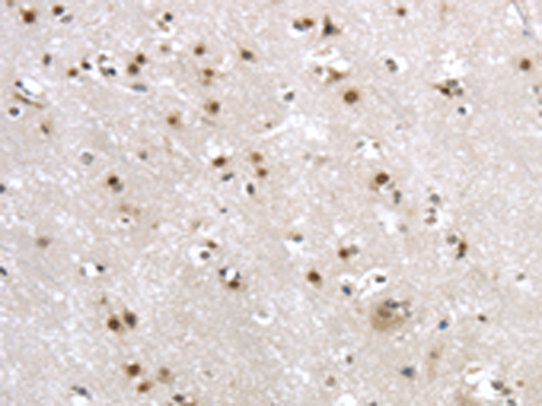 Rabbit Polyclonal Antibody to MRE11