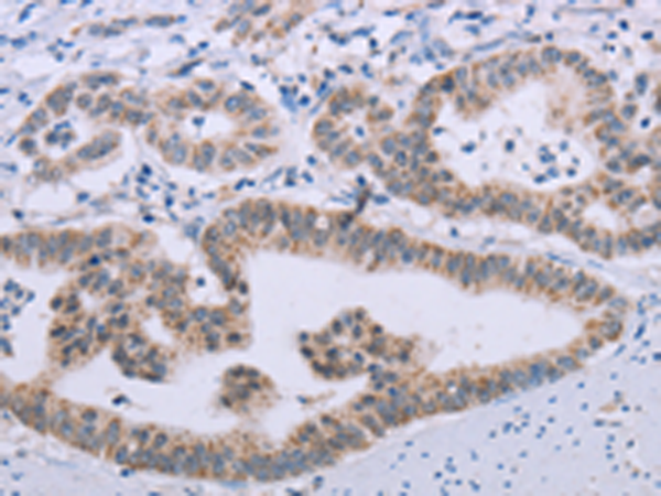 Rabbit Polyclonal Antibody to MRGPRX1