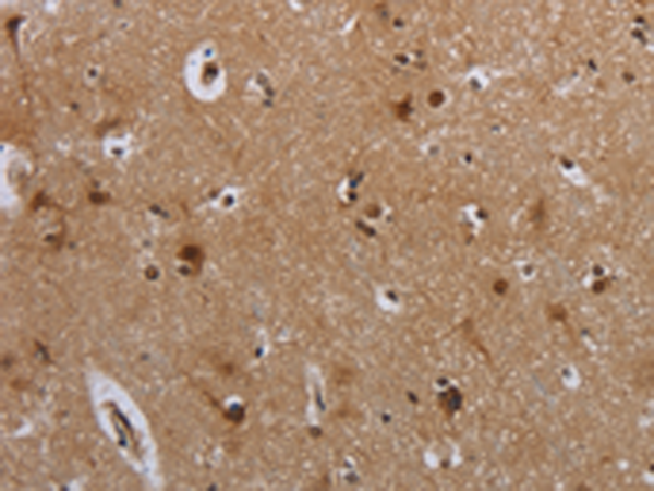 Rabbit Polyclonal Antibody to MTBP