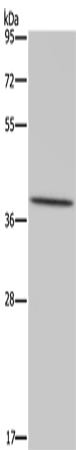 Rabbit Polyclonal Antibody to MT-ND1