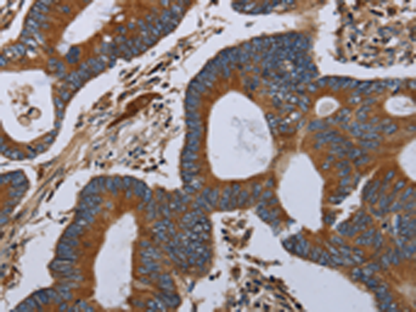 Rabbit Polyclonal Antibody to MT-ND6