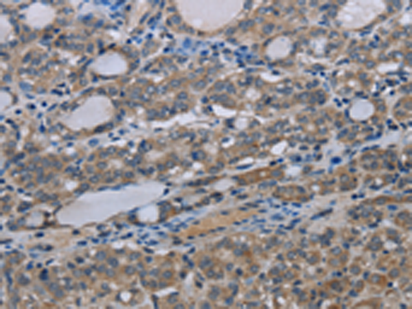 Rabbit Polyclonal Antibody to MT-ND3