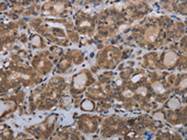 Rabbit Polyclonal Antibody to MTSS1