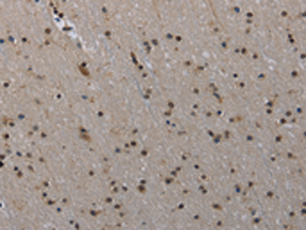 Rabbit Polyclonal Antibody to MVD